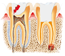 dolor dental